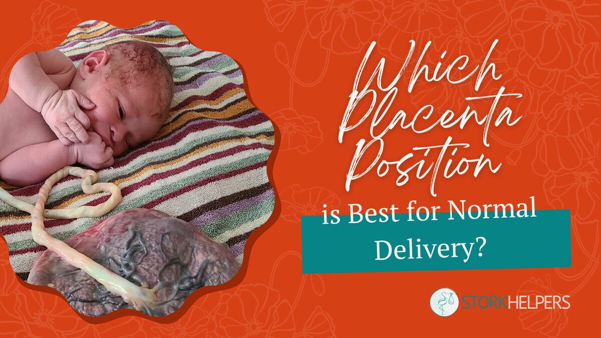 Which Placenta Position Is Good For Normal Delivery